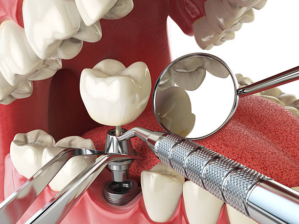 Best Emergency Treatment for Oral Infections in North Fork, CA